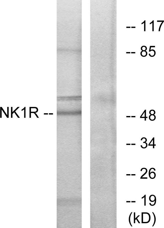 TACR1 / NK1R Antibody - Western blot analysis of lysates from Jurkat cells, using NK1R Antibody. The lane on the right is blocked with the synthesized peptide.