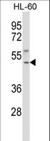 TACR1 / NK1R Antibody - TACR1 Antibody western blot of HL-60 cell line lysates (35 ug/lane). The TACR1 antibody detected the TACR1 protein (arrow).
