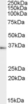 TACR1 / NK1R Antibody - Antibody (1 ug/ml) staining of Human Testes lysate (35 ug protein in RIPA buffer). Primary incubation was 1 hour. Detected by chemiluminescence.