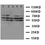 TACR1 / NK1R Antibody - WB of TACR1 / NK1R antibody. Lane 1: A549 Cell Lysate. Lane 2: U87 Cell Lysate. Lane 3: COLO320 Cell Lysate. Lane 4: SCG Cell Lysate. Lane 5: PANC Cell Lysate.