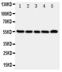 TACR1 / NK1R Antibody - Anti-TACR1 antibody, Western blotting All lanes: Anti TACR1 at 0.5ug/ml Lane 1: A549 Whole Cell Lysate at 40ug Lane 2: U87 Whole Cell Lysate at 40ug Lane 3: COLO320 Whole Cell Lysate at 40ug Lane 4: SCG Whole Cell Lysate at 40ug Lane 5: PANC Whole Cell Lysate at 40ug Predicted bind size: 45KD Observed bind size: 55KD