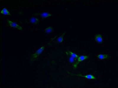 TACR1 / NK1R Antibody - Immunofluorescent analysis of NIH/3T3 cells using TACR1 Antibody at dilution of 1:100 and Alexa Fluor 488-congugated AffiniPure Goat Anti-Rabbit IgG(H+L)