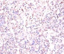 TACR1 / NK1R Antibody - Immunohistochemistry of paraffin-embedded human spleem tissue using TACR1 Antibody at dilution of 1:100