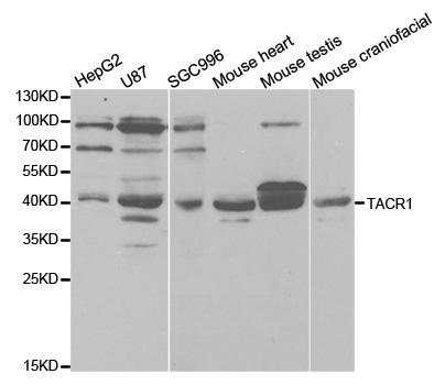 TACR1 / NK1R Antibody - Western blot analysis of extracts of various cell lines.