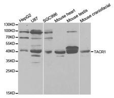 TACR1 / NK1R Antibody - Western blot analysis of extracts of various cell lines.