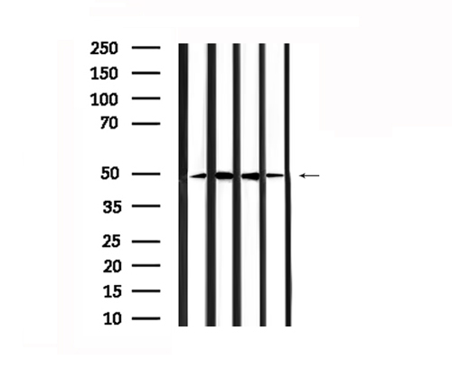 TACR1 / NK1R Antibody - Western blot analysis of extracts of 293, HepG2, rat brain and mouse lung using NK1R antibody.