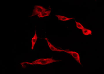 TACR1 / NK1R Antibody - Staining HeLa cells by IF/ICC. The samples were fixed with PFA and permeabilized in 0.1% Triton X-100, then blocked in 10% serum for 45 min at 25°C. The primary antibody was diluted at 1:200 and incubated with the sample for 1 hour at 37°C. An Alexa Fluor 594 conjugated goat anti-rabbit IgG (H+L) Ab, diluted at 1/600, was used as the secondary antibody.