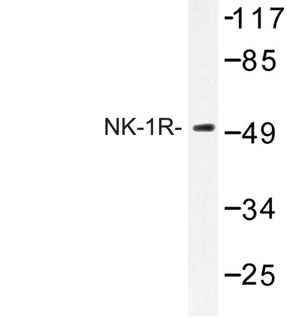 TACR1 / NK1R Antibody - Western blot of NK-1R (K245) pAb in extracts from Jurkat cells.