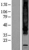 TACR1 / NK1R Protein - Western validation with an anti-DDK antibody * L: Control HEK293 lysate R: Over-expression lysate