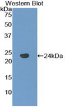 TACR2 / NK2R Antibody - Western blot of recombinant TACR2 / Nk2 / NK2R.  This image was taken for the unconjugated form of this product. Other forms have not been tested.