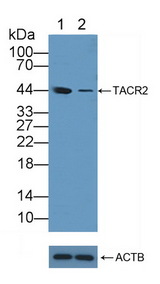 TACR2 / NK2R Antibody - Knockout Varification: Lane 1: Wild-type Hela cell lysate; Lane 2: TACR2 knockout Hela cell lysate; Predicted MW: 44kd Observed MW: 44kd Primary Ab: 1µg/ml Rabbit Anti-Human TACR2 Antibody Second Ab: 0.2µg/mL HRP-Linked Caprine Anti-Rabbit IgG Polyclonal Antibody