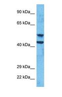 TACR2 / NK2R Antibody - Western blot of NK2R Antibody with human 786-0 Whole Cell lysate.  This image was taken for the unconjugated form of this product. Other forms have not been tested.