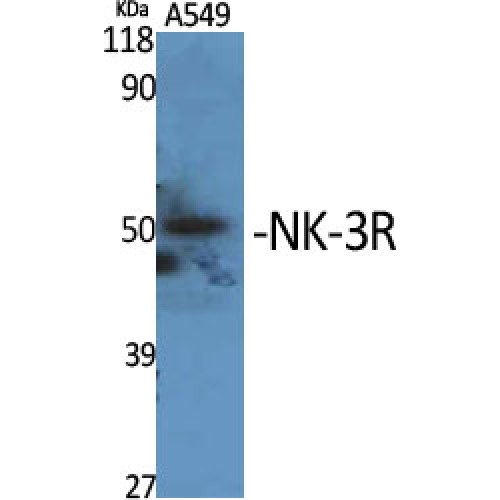 TACR3 / NK3R Antibody - Western blot of NK-3R antibody