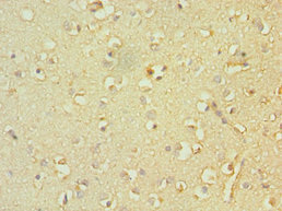 TACR3 / NK3R Antibody - Immunohistochemistry of paraffin-embedded human brain tissue using TACR3 Antibody at dilution of 1:100