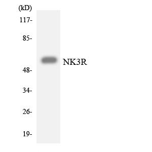 TACR3 / NK3R Antibody - Western blot analysis of the lysates from HepG2 cells using NK3R antibody.