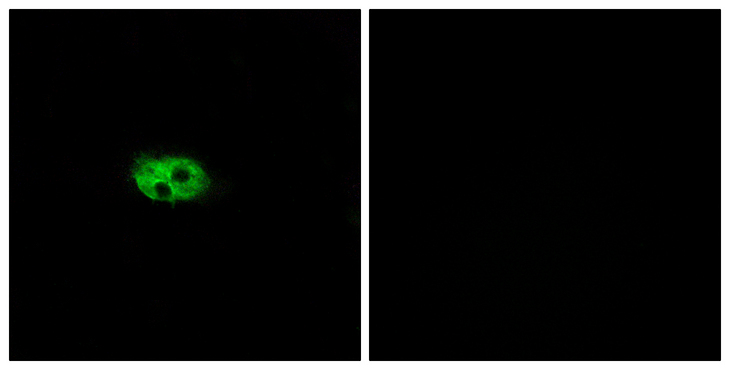 TACR3 / NK3R Antibody - Immunofluorescence analysis of A549 cells, using NK3R Antibody. The picture on the right is blocked with the synthesized peptide.