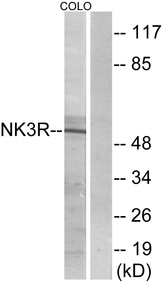 TACR3 / NK3R Antibody - Western blot analysis of lysates from COLO205 cells, using NK3R Antibody. The lane on the right is blocked with the synthesized peptide.