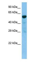 TACR3 / NK3R Antibody - TACR3 / NK3R antibody Western Blot of NCI-H226.  This image was taken for the unconjugated form of this product. Other forms have not been tested.