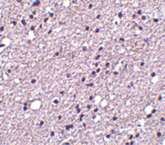 TACR3 / NK3R Antibody - Immunohistochemistry of NK3R in human brain tissue with NK3R antibody at 5 ug/ml.