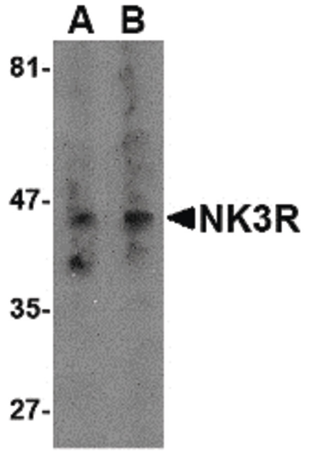 TACR3 / NK3R Antibody - Western blot of NK3R in RAW264.7 cell lysate with NK3R antibody at (A) 0.5 and (B) 2 ug/ml.