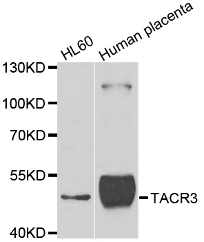 TACR3 / NK3R Antibody - Western blot analysis of extracts of various cell lines.