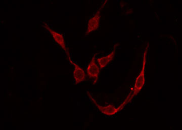 TACR3 / NK3R Antibody - Staining COLO205 cells by IF/ICC. The samples were fixed with PFA and permeabilized in 0.1% Triton X-100, then blocked in 10% serum for 45 min at 25°C. The primary antibody was diluted at 1:200 and incubated with the sample for 1 hour at 37°C. An Alexa Fluor 594 conjugated goat anti-rabbit IgG (H+L) Ab, diluted at 1/600, was used as the secondary antibody.