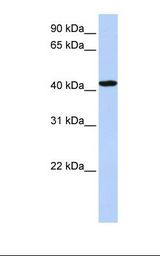 TADA1 / ADA1 Antibody - Hela cell lysate. Antibody concentration: 1.0 ug/ml. Gel concentration: 12%.  This image was taken for the unconjugated form of this product. Other forms have not been tested.