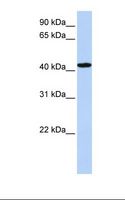 TADA1 / ADA1 Antibody - Hela cell lysate. Antibody concentration: 1.0 ug/ml. Gel concentration: 12%.  This image was taken for the unconjugated form of this product. Other forms have not been tested.