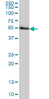 TADA2B Antibody - MGC21874 monoclonal antibody (M08), clone 1C8 Western blot of MGC21874 expression in HeLa.