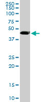 TADA2B Antibody - MGC21874 monoclonal antibody (M08), clone 1C8. Western blot of MGC21874 expression in PC-12.