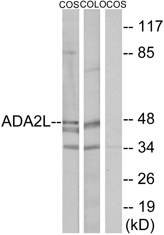 TADA2L / ADA2A Antibody - Western blot analysis of lysates from COS7 and COLO205 cells, using ADA2L Antibody. The lane on the right is blocked with the synthesized peptide.