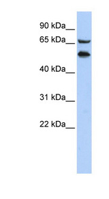 TADA2L / ADA2A Antibody - TADA2A / TADA2L antibody Western blot of HepG2 cell lysate. This image was taken for the unconjugated form of this product. Other forms have not been tested.