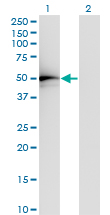 TADA2L / ADA2A Antibody - Western Blot analysis of TADA2L expression in transfected 293T cell line by TADA2L monoclonal antibody (M01), clone 4A8-1A7.Lane 1: TADA2L transfected lysate (Predicted MW: 51.5 KDa).Lane 2: Non-transfected lysate.
