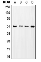 TADA2L / ADA2A Antibody - Western blot analysis of ADA2A expression in MCF7 (A); SP2/0 (B); H9C2 (C); mouse testis (D) whole cell lysates.