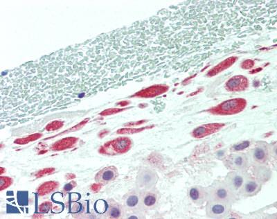 TADA2L / ADA2A Antibody - Human Placenta, Amnion: Formalin-Fixed, Paraffin-Embedded (FFPE)