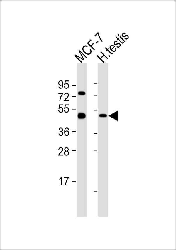 TADA2L / ADA2A Antibody - All lanes : Anti-ADA2A Antibody at 1:1000 dilution Lane 1: MCF-7 whole cell lysates Lane 2: human testis lysates Lysates/proteins at 20 ug per lane. Secondary Goat Anti-Rabbit IgG, (H+L),Peroxidase conjugated at 1/10000 dilution Predicted band size : 52 kDa Blocking/Dilution buffer: 5% NFDM/TBST.