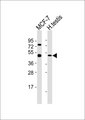 TADA2L / ADA2A Antibody - All lanes : Anti-ADA2A Antibody at 1:1000 dilution Lane 1: MCF-7 whole cell lysates Lane 2: human testis lysates Lysates/proteins at 20 ug per lane. Secondary Goat Anti-Rabbit IgG, (H+L),Peroxidase conjugated at 1/10000 dilution Predicted band size : 52 kDa Blocking/Dilution buffer: 5% NFDM/TBST.