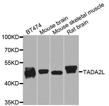 TADA2L / ADA2A Antibody - Western blot analysis of extracts of various cells.