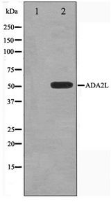 TADA2L / ADA2A Antibody - Western blot of COLO205 cell lysate using ADA2L Antibody