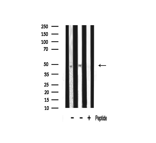 TADA2L / ADA2A Antibody - Western blot analysis of ADA2L expression in various lysates