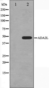 TADA2L / ADA2A Antibody - Western blot analysis on COLO205 cell lysates using ADA2L antibody. The lane on the left is treated with the antigen-specific peptide.