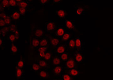 TADA2L / ADA2A Antibody - Staining COS7 cells by IF/ICC. The samples were fixed with PFA and permeabilized in 0.1% Triton X-100, then blocked in 10% serum for 45 min at 25°C. The primary antibody was diluted at 1:200 and incubated with the sample for 1 hour at 37°C. An Alexa Fluor 594 conjugated goat anti-rabbit IgG (H+L) Ab, diluted at 1/600, was used as the secondary antibody.