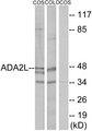 TADA2L / ADA2A Antibody - Western blot analysis of extracts from COS-7 cells and COLO205 cells, using ADA2L antibody.