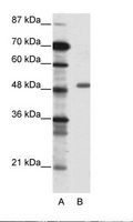 TADA3 / ADA3 Antibody - A: Marker, B: Jurkat Cell Lysate.  This image was taken for the unconjugated form of this product. Other forms have not been tested.