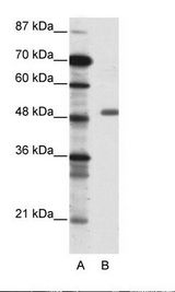 TADA3 / ADA3 Antibody - A: Marker, B: Jurkat Cell Lysate.  This image was taken for the unconjugated form of this product. Other forms have not been tested.