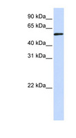 TADA3 / ADA3 Antibody - TADA3 / TADA3L antibody Western blot of Transfected 293T cell lysate. This image was taken for the unconjugated form of this product. Other forms have not been tested.
