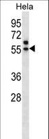 TADA3 / ADA3 Antibody - TADA3L Antibody western blot of HeLa cell line lysates (35 ug/lane). The TADA3L antibody detected the TADA3L protein (arrow).