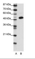 TADA3 / ADA3 Antibody - A: Marker, B: Transfected 293T Cell Lysate.  This image was taken for the unconjugated form of this product. Other forms have not been tested.