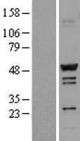 TADA3 / ADA3 Protein - Western validation with an anti-DDK antibody * L: Control HEK293 lysate R: Over-expression lysate