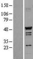 TADA3 / ADA3 Protein - Western validation with an anti-DDK antibody * L: Control HEK293 lysate R: Over-expression lysate